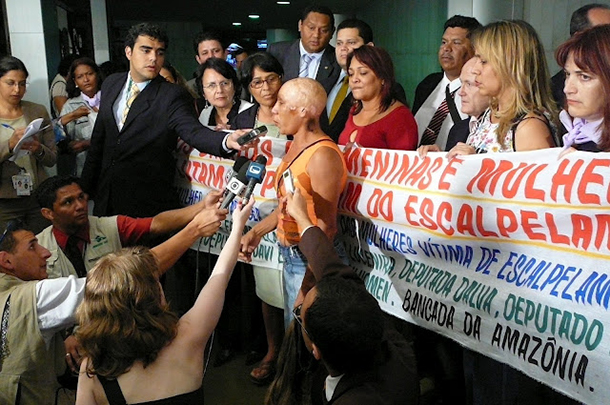 20140710-escalpelamento610