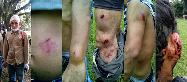 20150303-Risaralda6fotos610