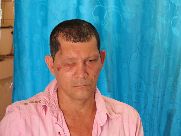 20150819-Carlos-Ossa-Trejos610-1